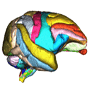 Labeled MRI-Based Model
